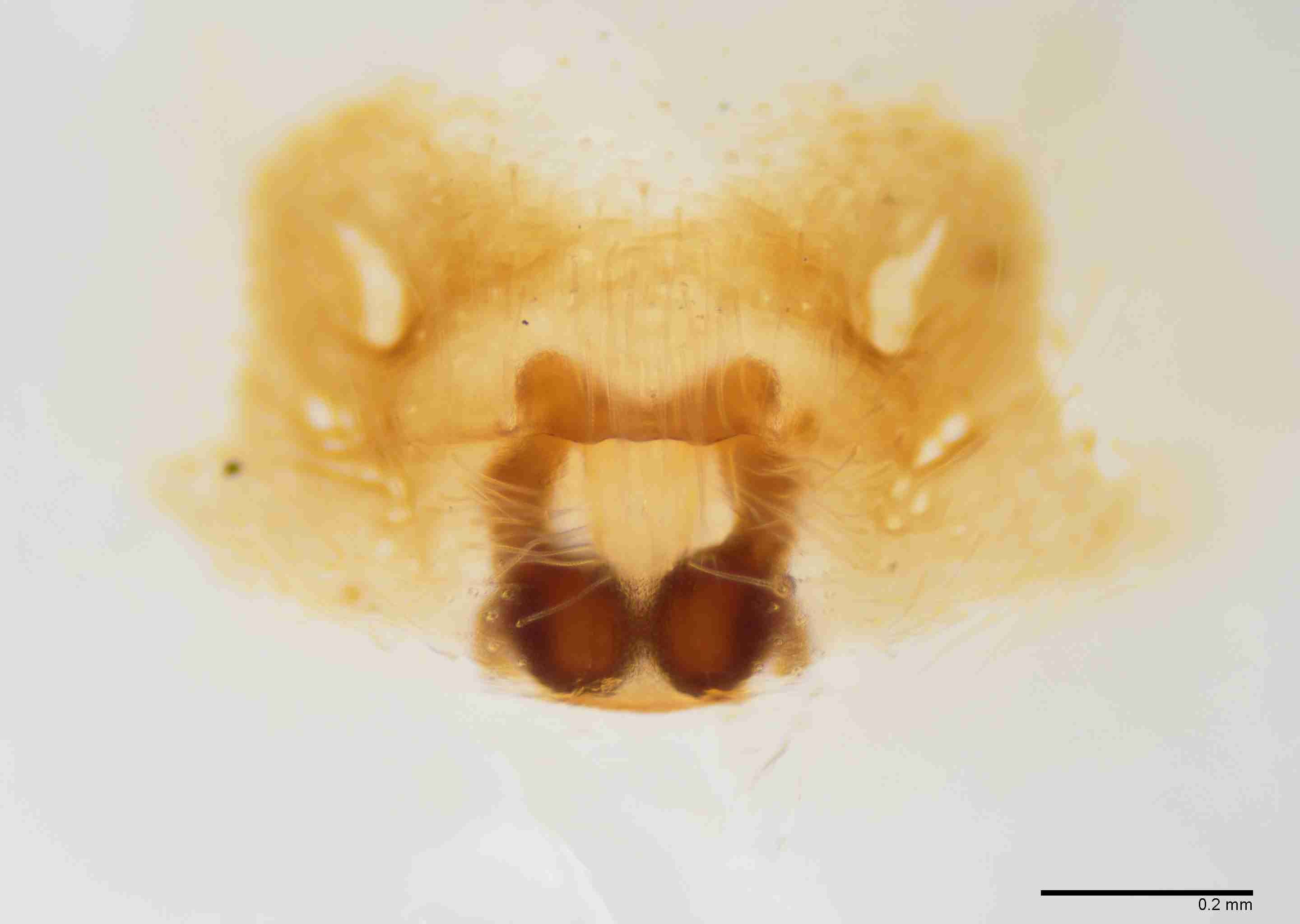 INVPICV015fpepivXAM101_100X_E2B.jpg