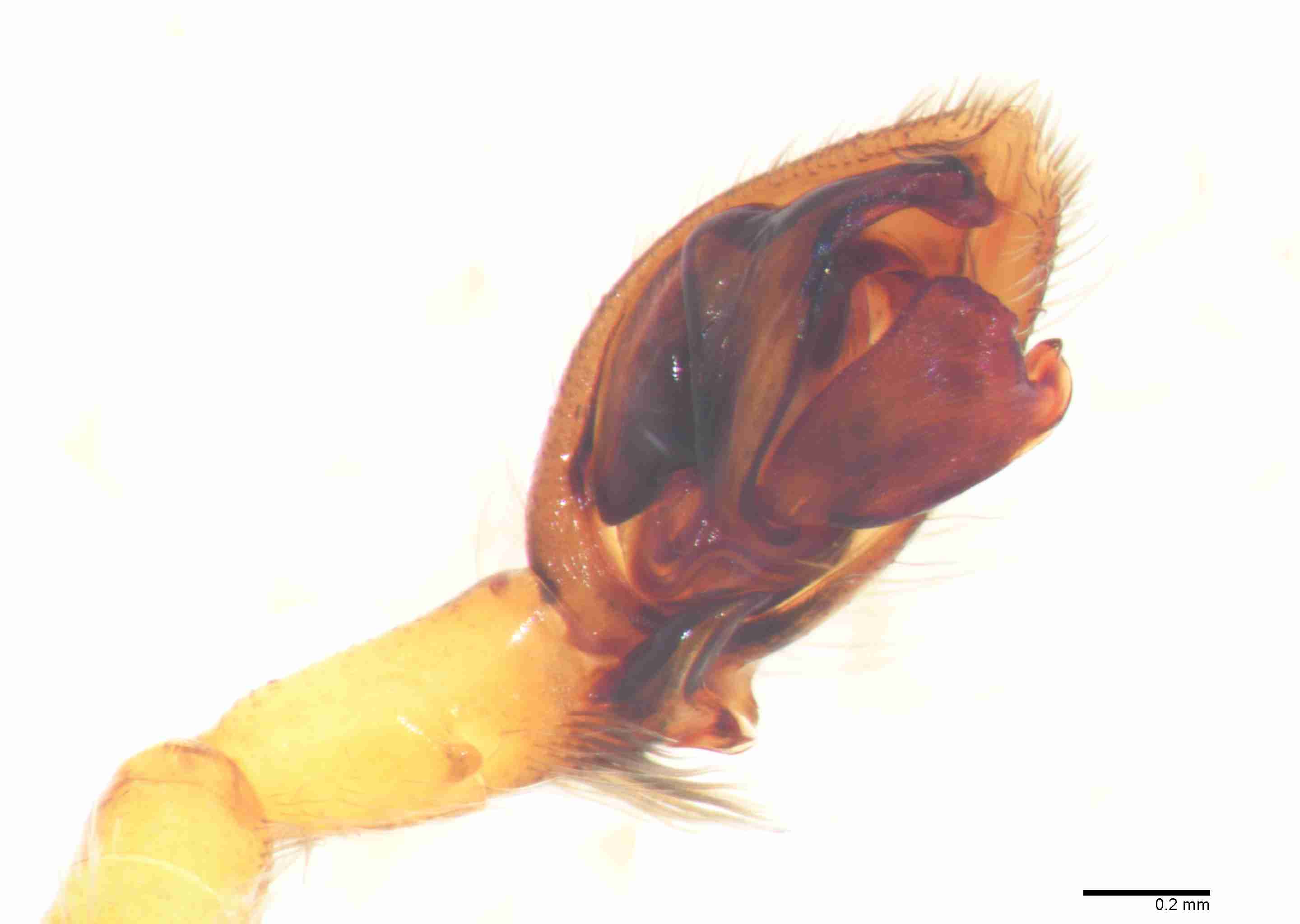 INVPICV018mppalvXAM105_60X_Z10.jpg