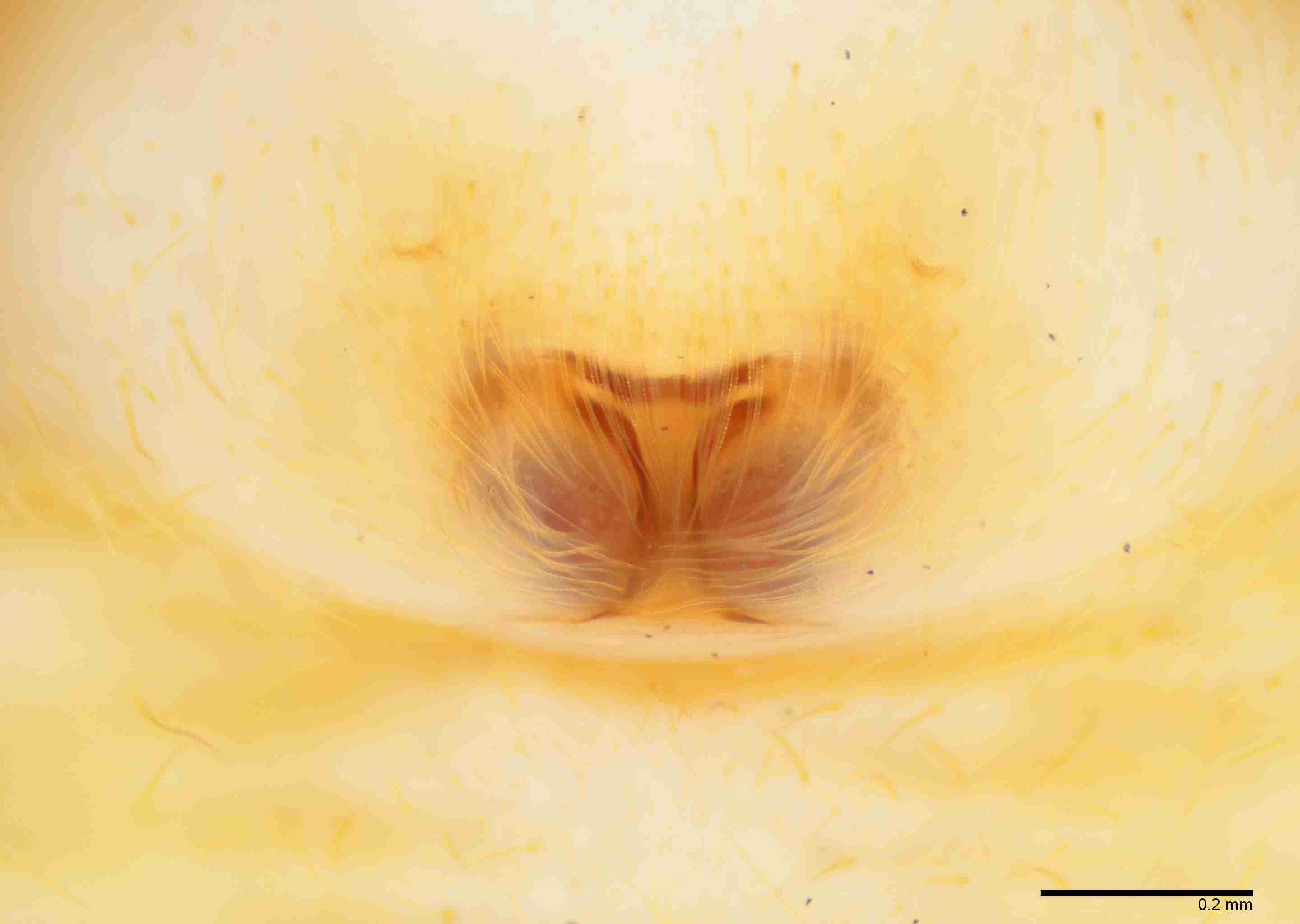 INVPICV019fpepivPXF215_100X_E2B.jpg