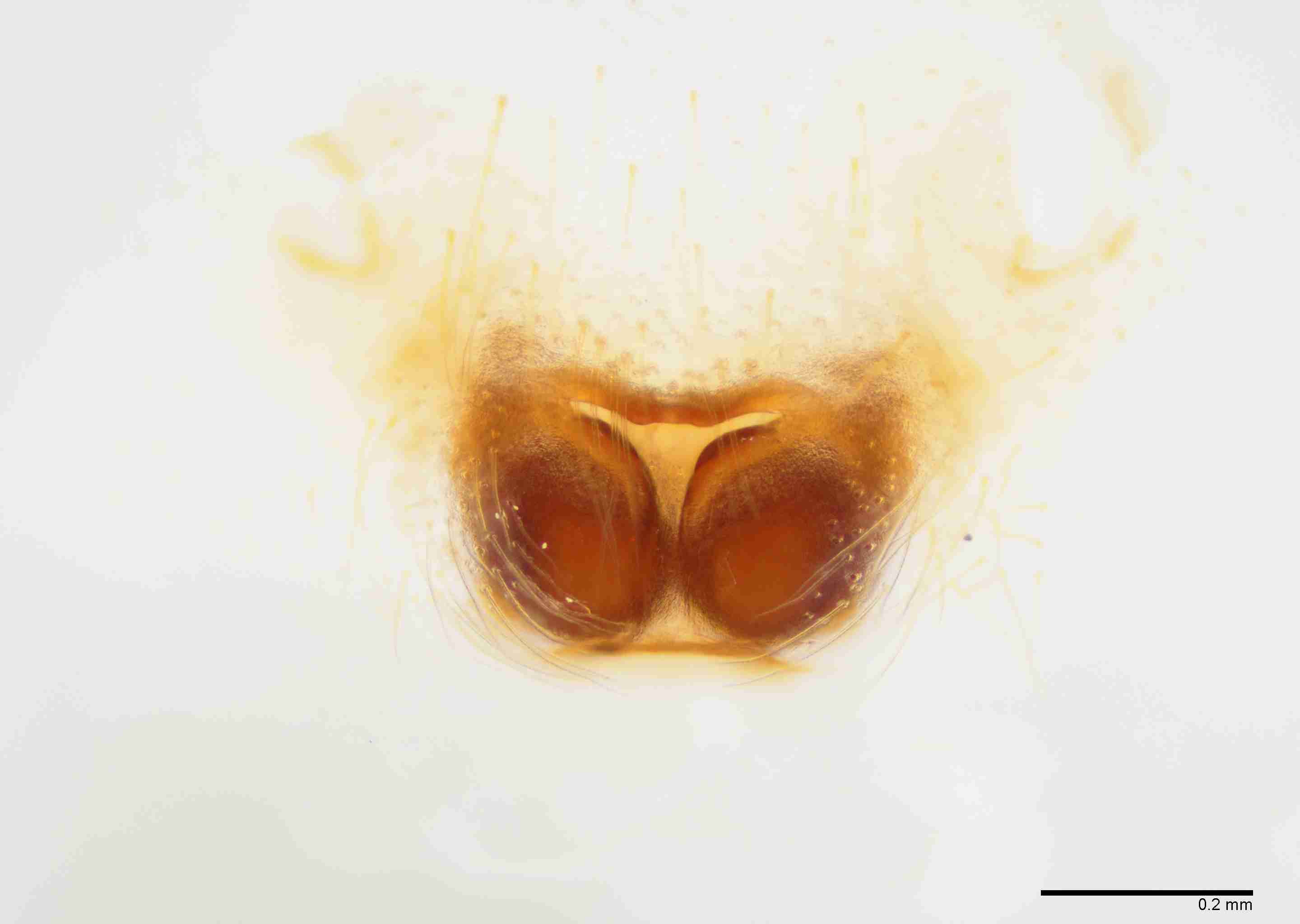 INVPICV019fpepivXAM102_100X_E2B.jpg
