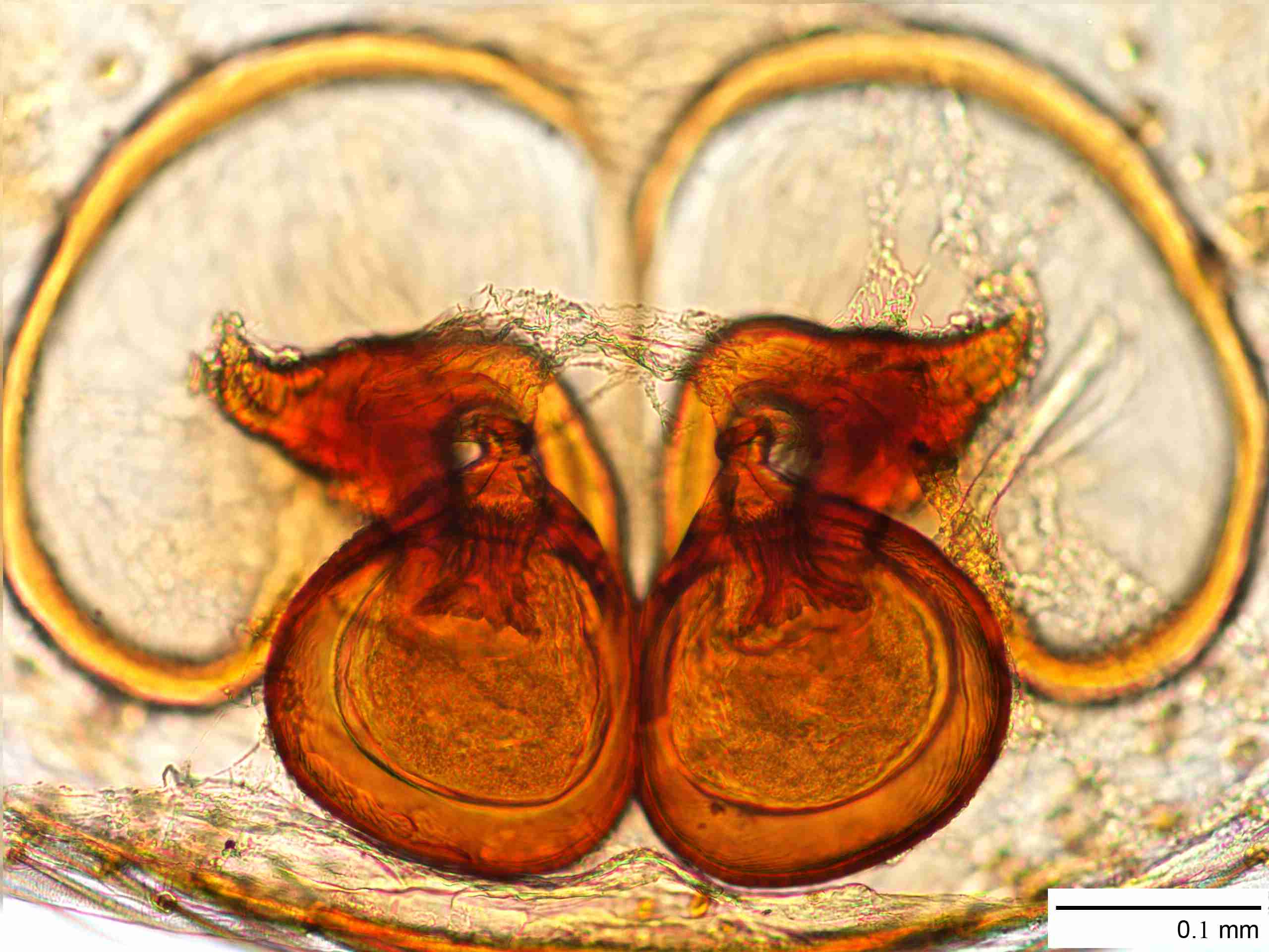 INVPICV170fcepidPSL033_200X_NL.jpg