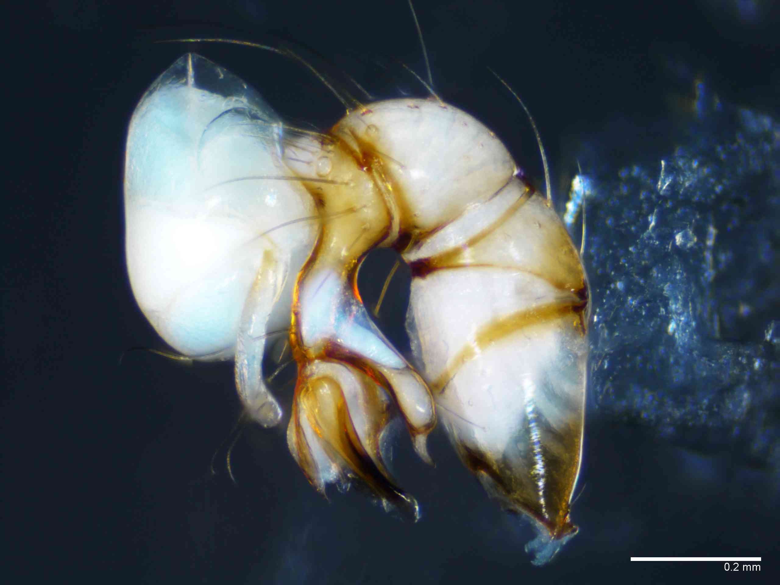 PHOLCI0098mppalrTXV268_100X_E2A.jpg
