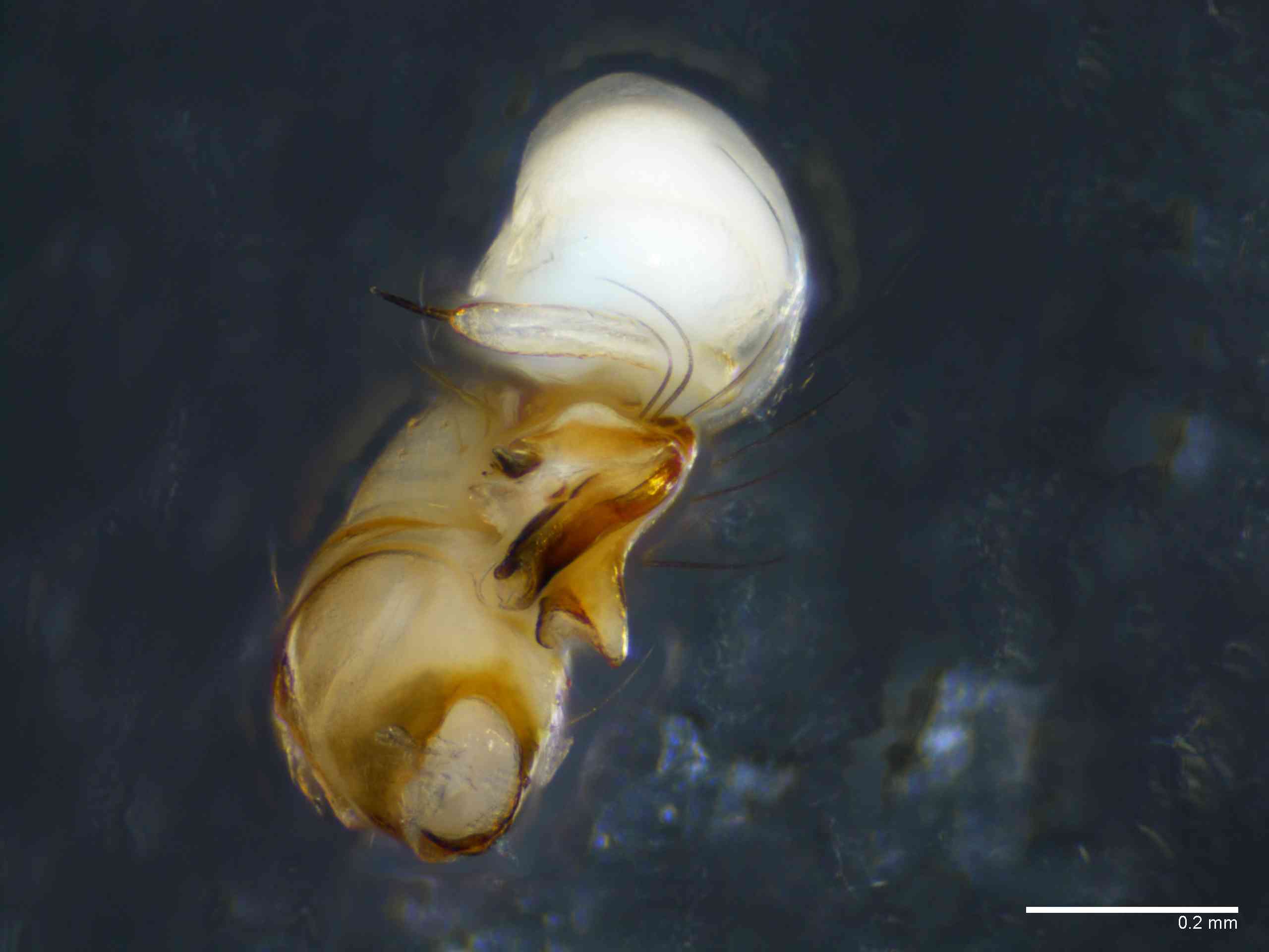 PHOLCI0098mppalvTXV268_100X_E2A.jpg
